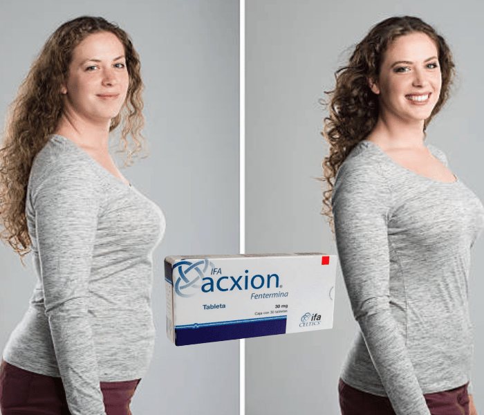 acxion-weight-loss-pills